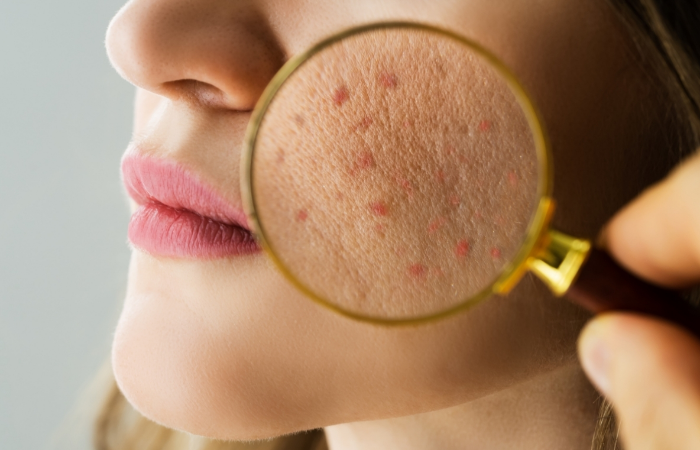 Her Gün Yaptığımız Ve Cildimize Hasar Veren 9 Şey 