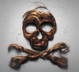 Ishrs (Uluslar Arasi Saç Restorasyon Cerrahisi Derneği), Medikal Turizm Adi Altinda Yasal Olmayan Ve Tehlikeli Saç Ekimi Konusunda Uyari Yapti 