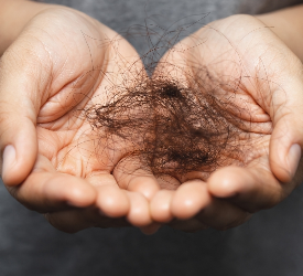 Mevsimsel Saç Dökülmesi Nedir