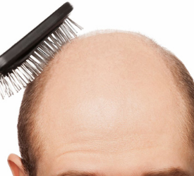 Şampuanıma  Doğum Kontrol Hapı Atarsam Saç Dökülmem Durur Mu?