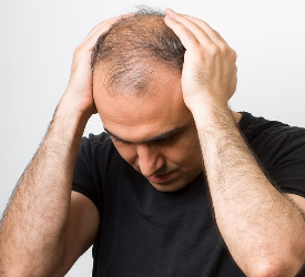 Saw Palmetto İle Saç Kaybi Doğal Yolla Önlenebilir mi?